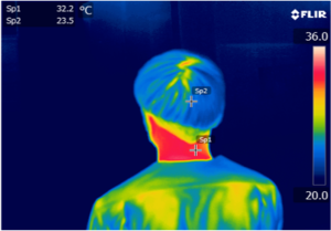 拭く前：首元温度32.2℃